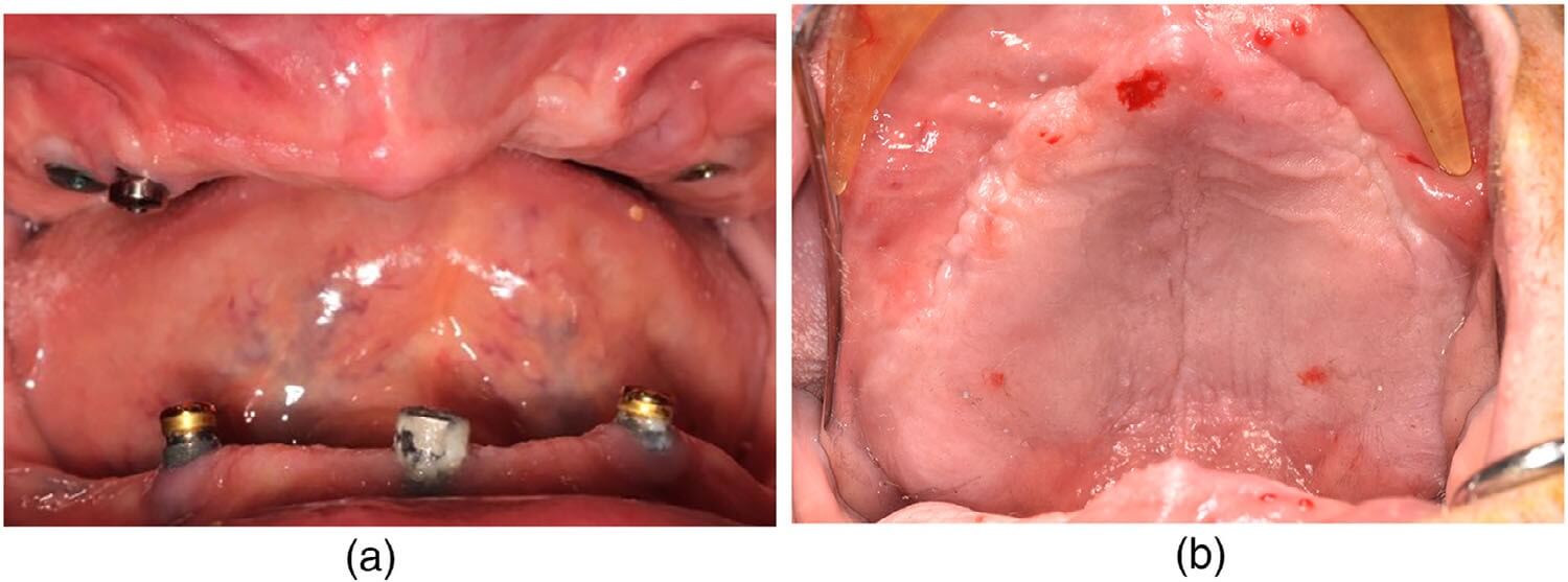 Preoperative frontal facial views