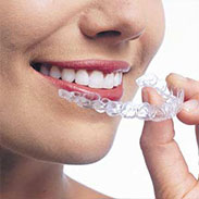 Invisalign Image