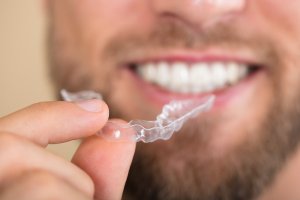 bearded man holds clear Invisalign alignment tray